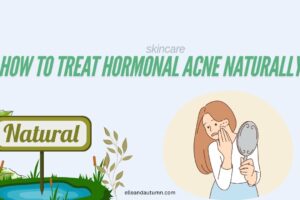 How to Treat Hormonal Acne Naturally